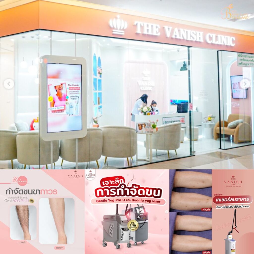 เลเซอร์ขนขาที่ The Vanish Clinic