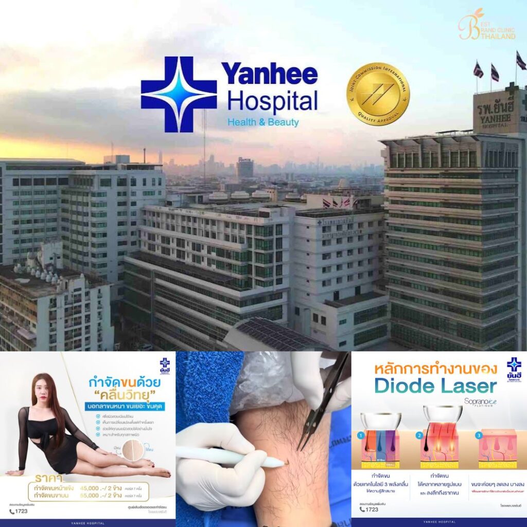 เลเซอร์ขนขาที่ Yanhee Hospital