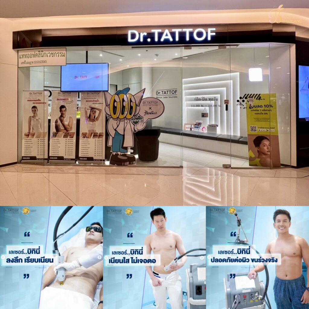 เลเซอร์ขนน้องชายที่ Dr. TATTOF Clinic