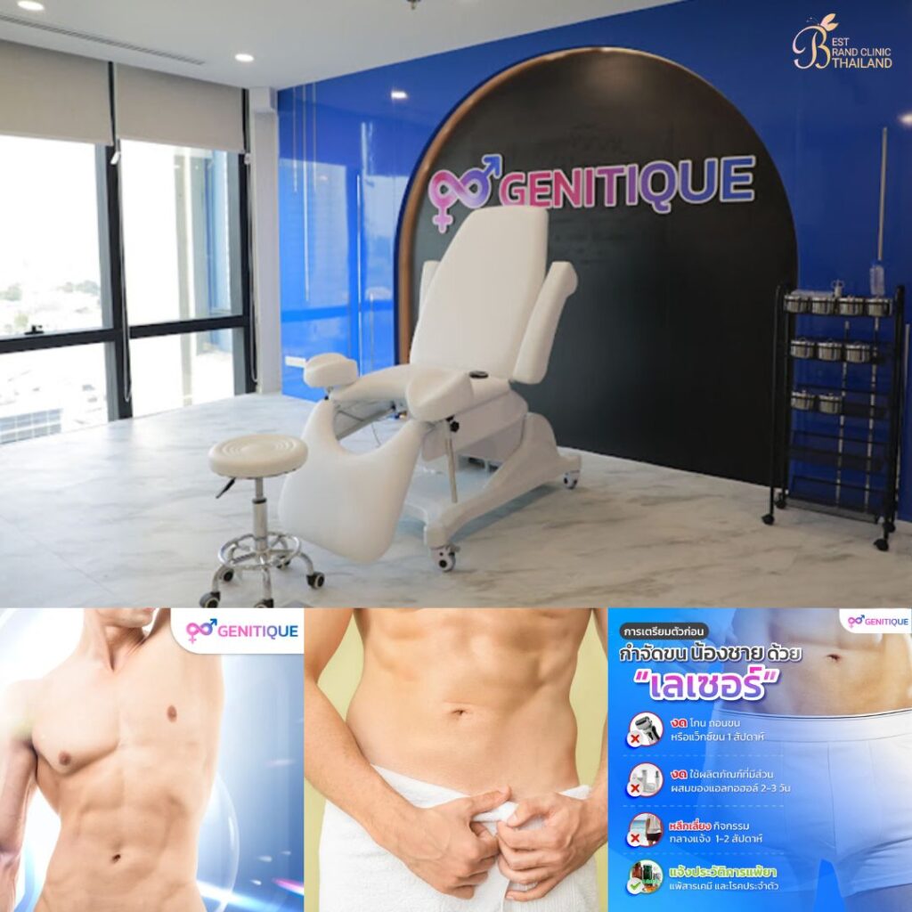 เลเซอร์ขนน้องชายที่ Genitique Clinic