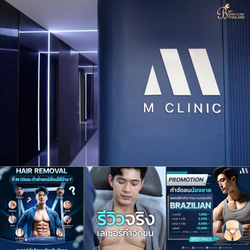 เลเซอร์ขนน้องชายที่ M Clinic