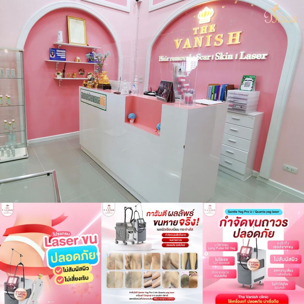 เลเซอร์ขนน้องชายที่ The Vanish Clinic