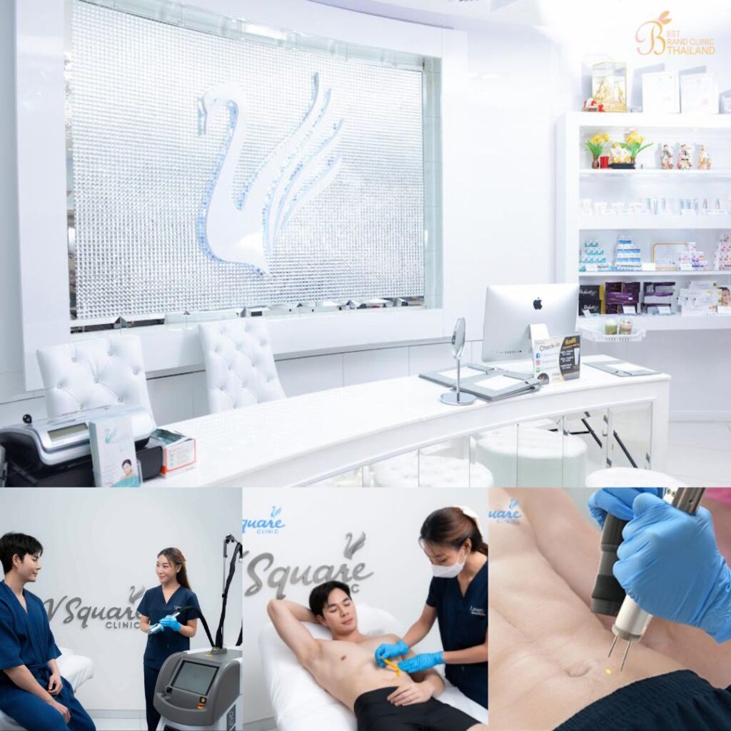 เลเซอร์ขนน้องชายที่ V Square Clinic