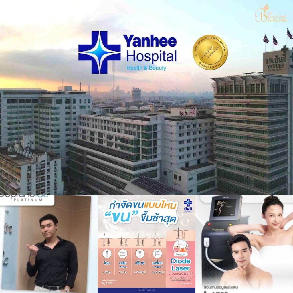 เลเซอร์ขนน้องชายที่ Yanhee Hospital
