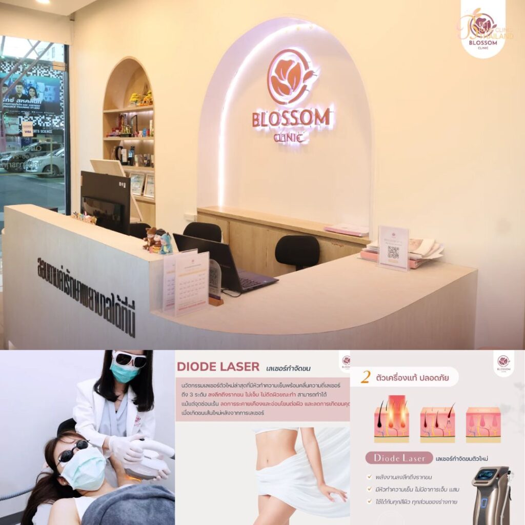 เลเซอร์ขนน้องสาวที่ Blossom Clinic