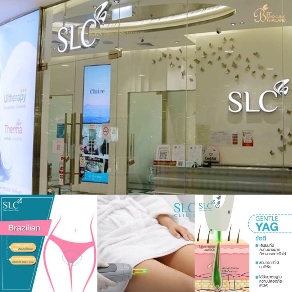เลเซอร์ขนน้องสาวที่ SLC Clinic