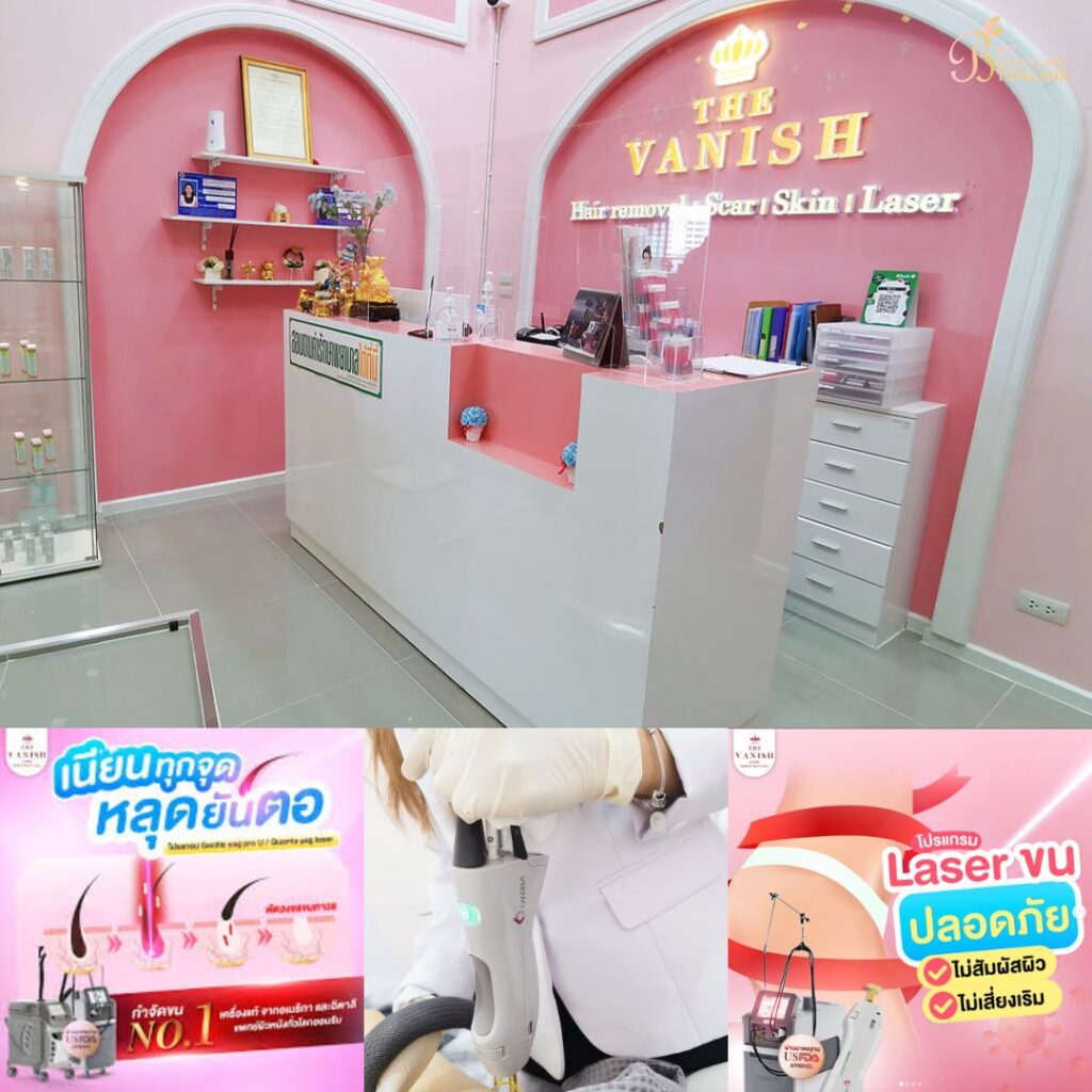 เลเซอร์ขนน้องสาวที่ The Vanish Clinic