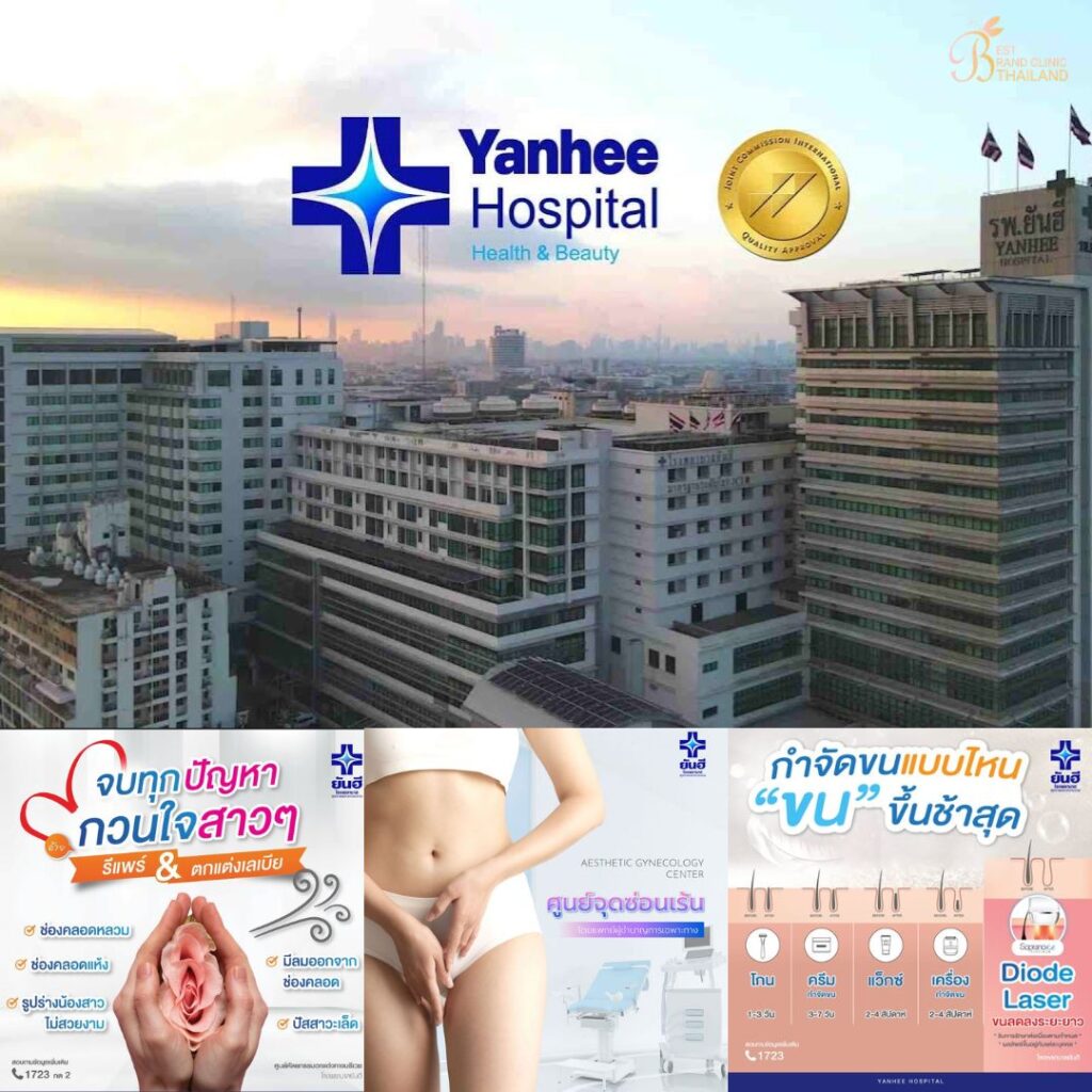 เลเซอร์ขนน้องสาวที่ Yanhee Hospital