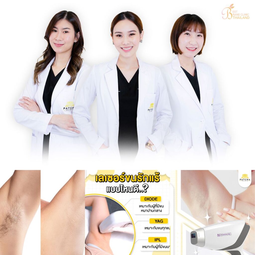 เลเซอร์ขนรักแร้ที่ Patcha Clinic
