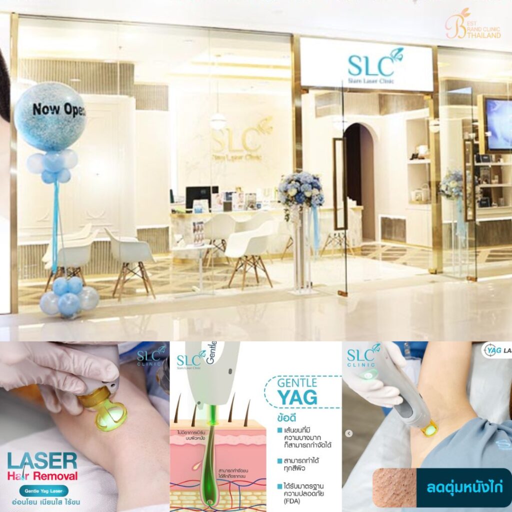 เลเซอร์ขนรักแร้ที่ SLC Clinic