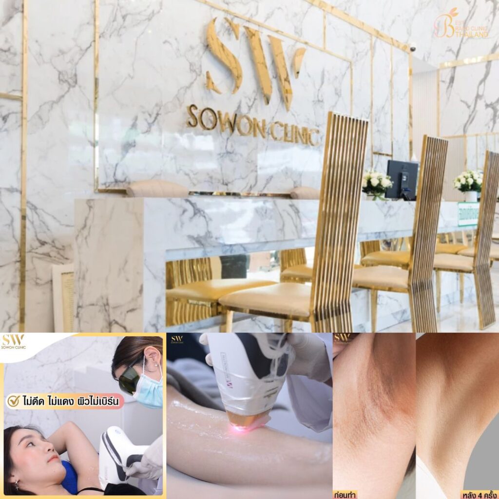 เลเซอร์ขนรักแร้ที่ Sowon Clinic