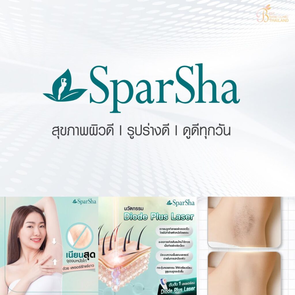 เลเซอร์ขนรักแร้ที่ Sparsha