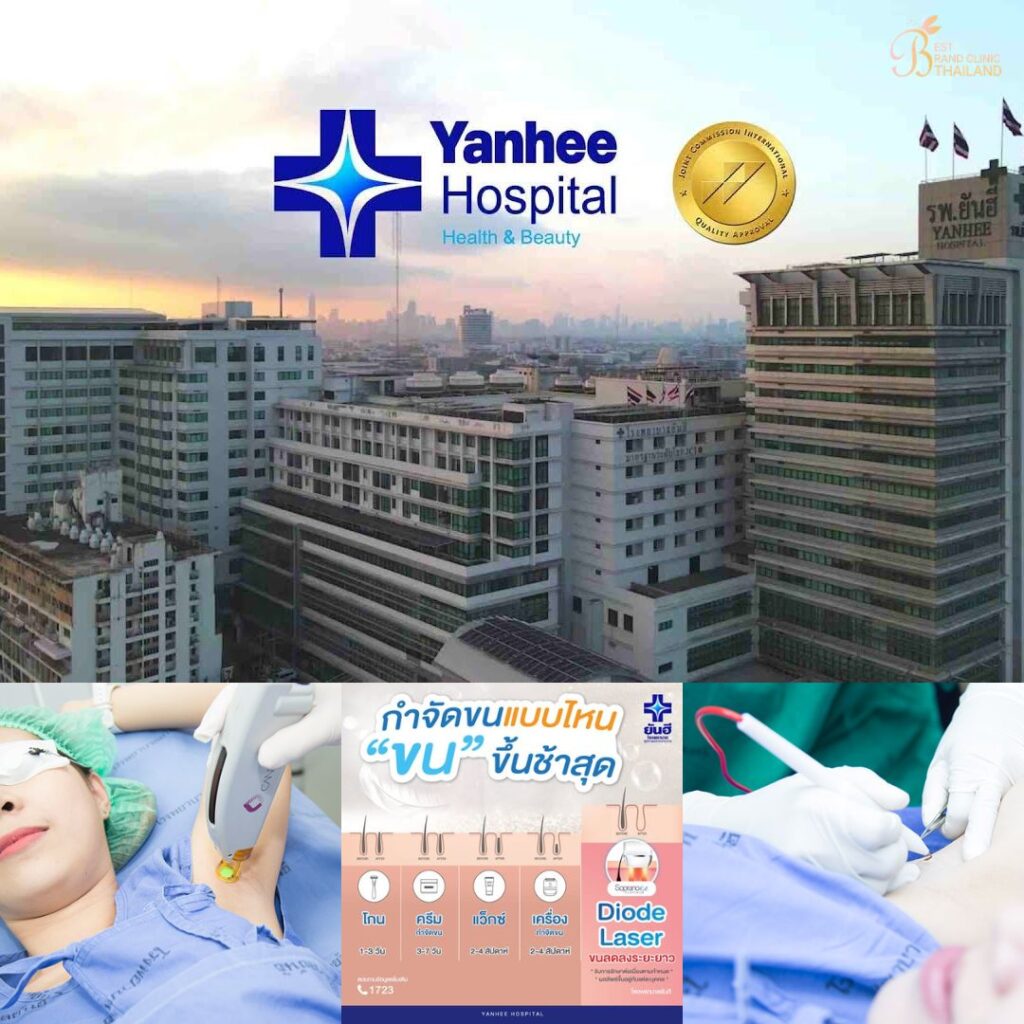 เลเซอร์ขนรักแร้ที่ Yanhee Hospital