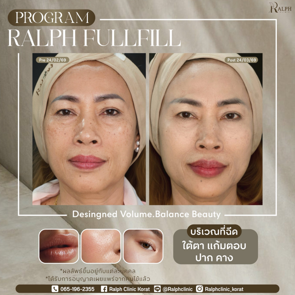 รีวิวคลินิกเสริมความงาม โคราชที่ Ralph Clinic Korat
