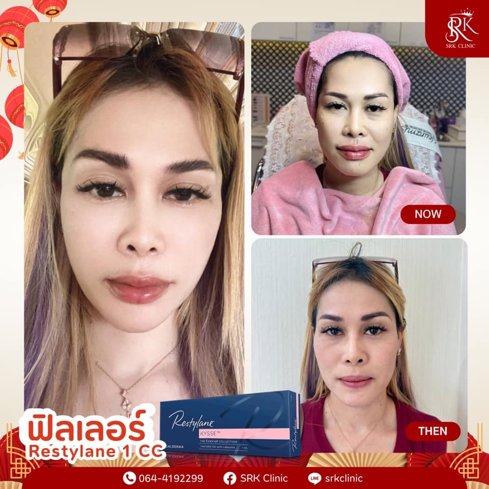 รีวิวคลินิกเสริมความงาม โคราชที่ Srk Clinic