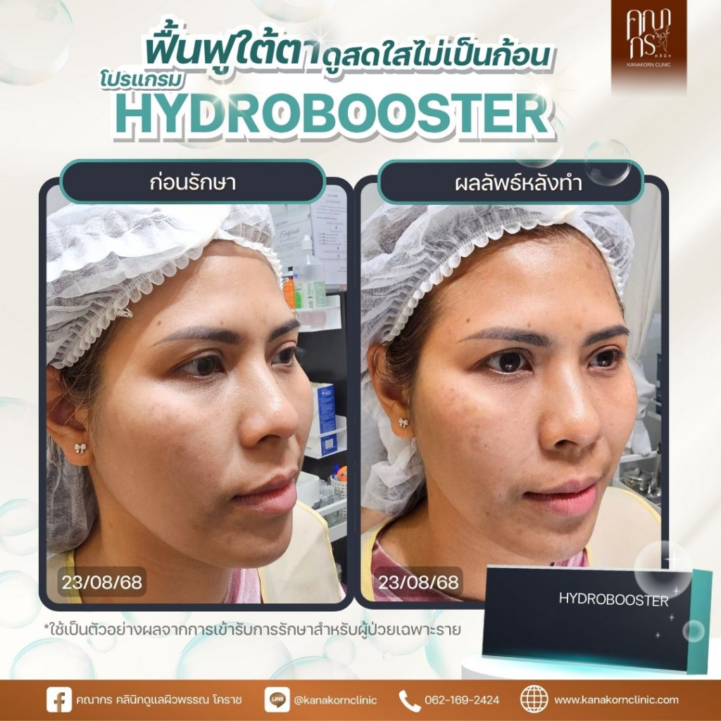 รีวิวคลินิกเสริมความงาม โคราชที่ คณากรคลินิก