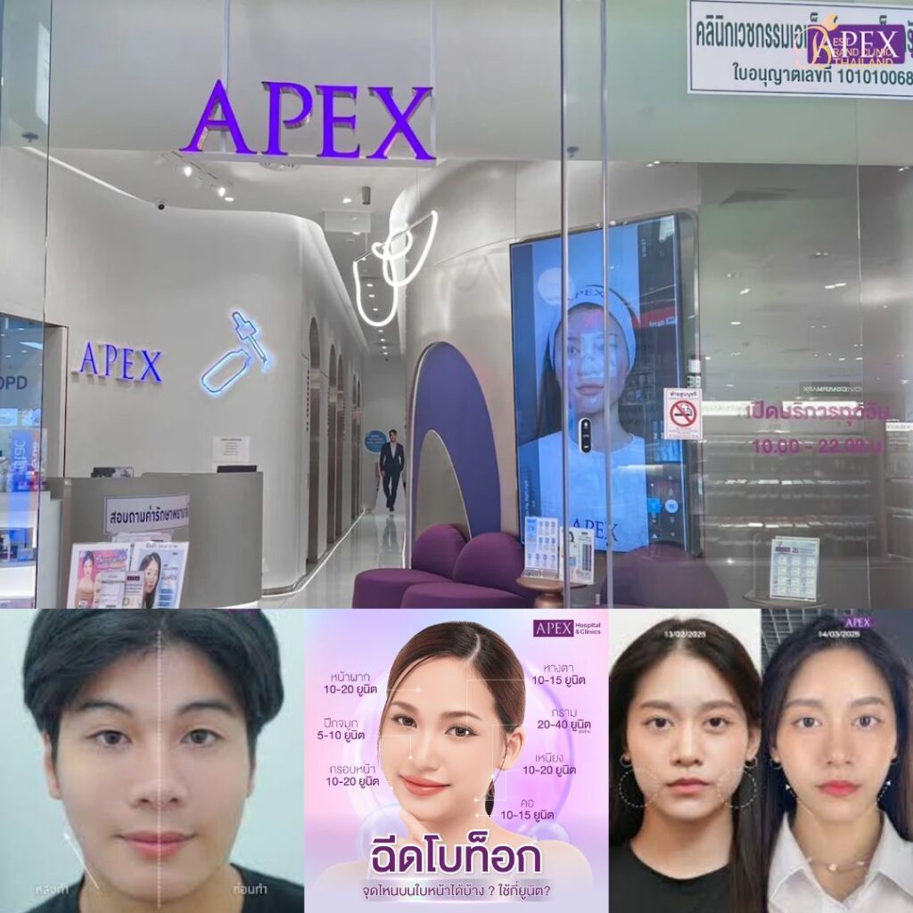 ฉีดโบท็อกซ์ที่ Apex Medical Center