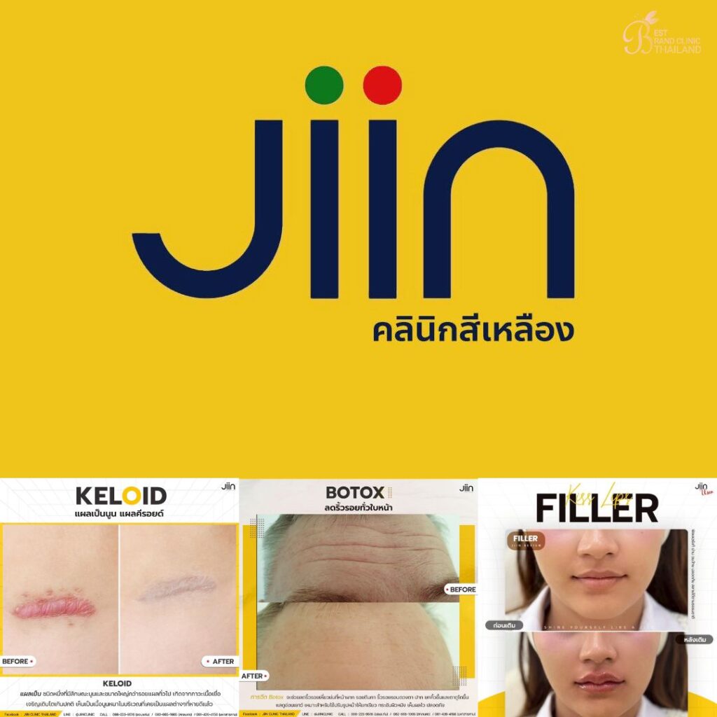 คลินิกเสริมความงามขอนแก่นที่ JIIN CLINIC
