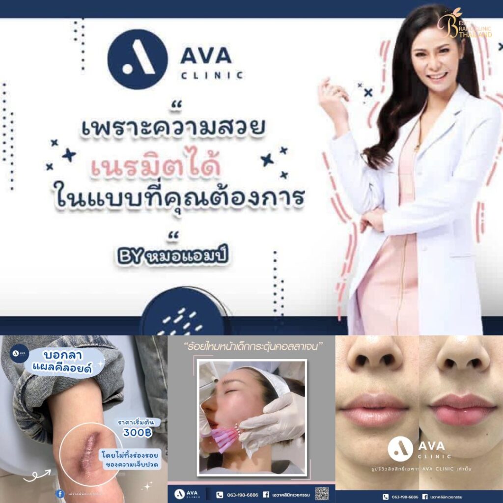คลินิกเสริมความงาม โคราชที่ AVA Clinic