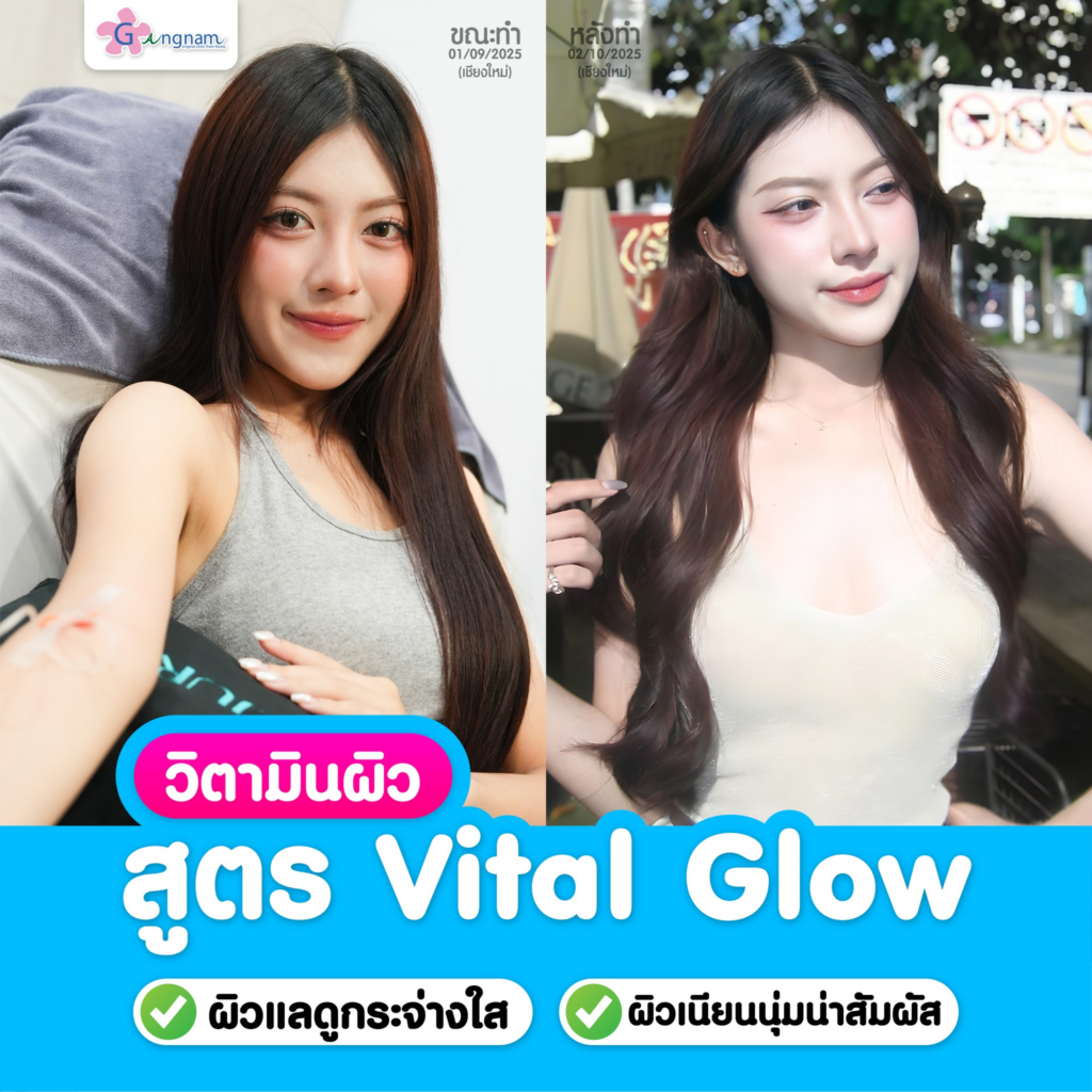รีวิวคลินิกเสริมความงามขอนแก่นที่ Gangnam Clinic
