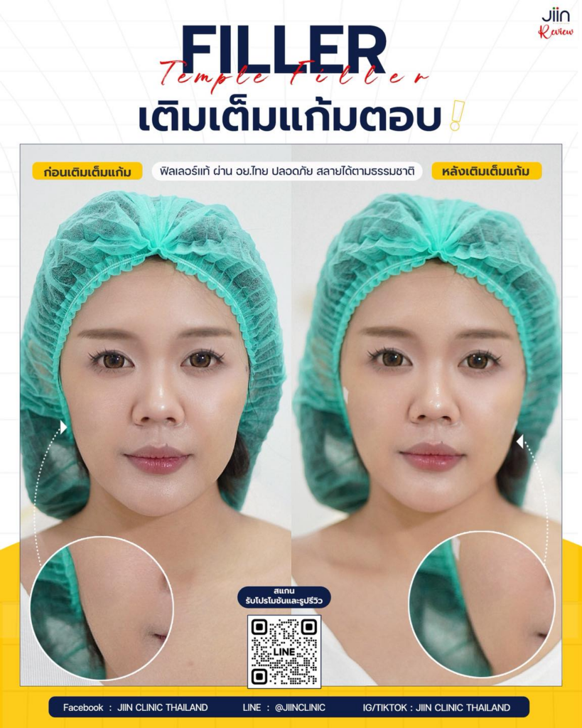 รีวิวคลินิกเสริมความงามขอนแก่นที่ JIIN CLINIC