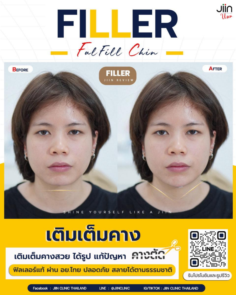 รีวิวคลินิกเสริมความงามขอนแก่นที่ JIIN CLINIC