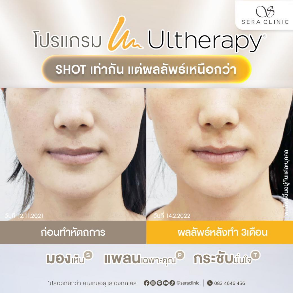 รีวิวคลินิกเสริมความงามสกลนครที่ Sera Clinic
