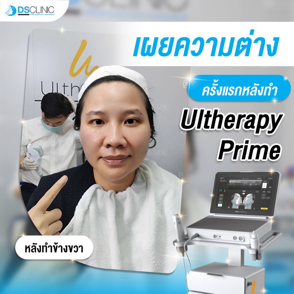 รีวิวคลินิกเสริมความงามสกลนครที่ Ds Clinic
