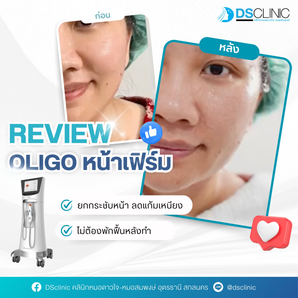 รีวิวคลินิกเสริมความงามสกลนครที่ Ds Clinic