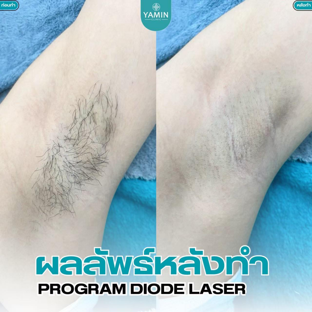 รีวิวคลินิกเสริมความงามสกลนครที่ Yamin Clinic