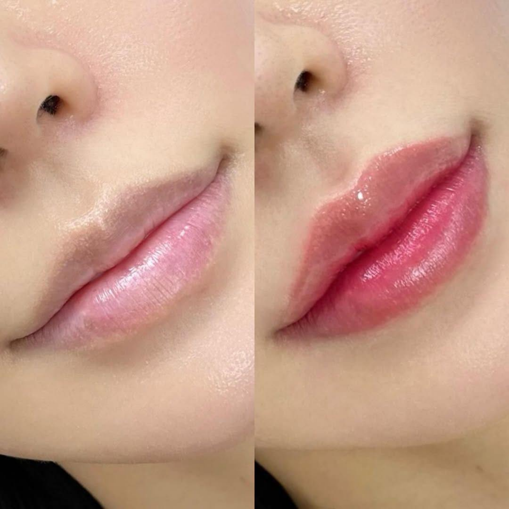 รีวิวคลินิกเสริมความงามสกลนครที่ Yamin Clinic