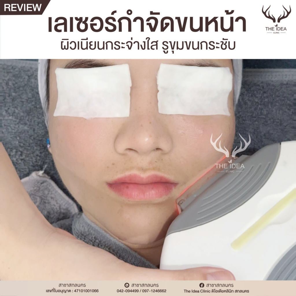 รีวิวคลินิกเสริมความงามสกลนครที่ The Idea Clinic