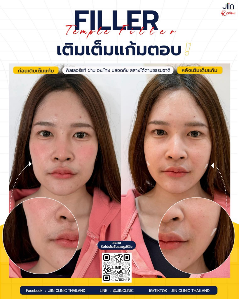 รีวิวคลินิกเสริมความงามสกลนครที่ JIIN CLINIC