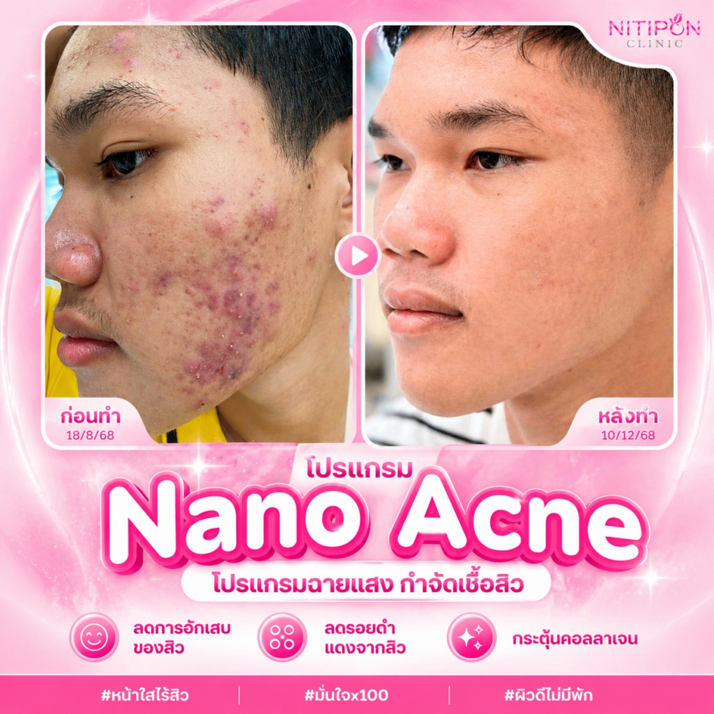 รีวิวคลินิกเสริมความงามสกลนครที่ นิติพลคลินิก