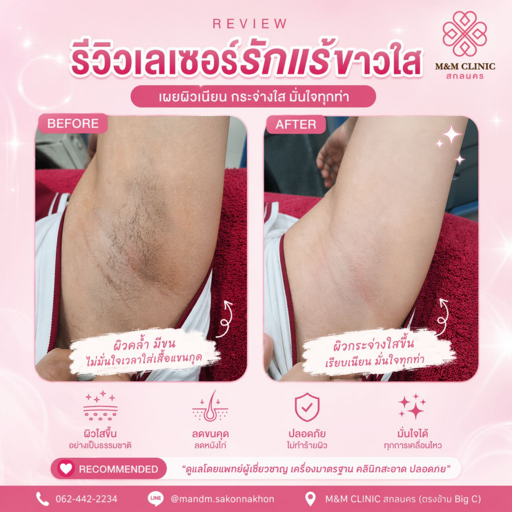 รีวิวคลินิกเสริมความงามสกลนครที่ M&M Clinic