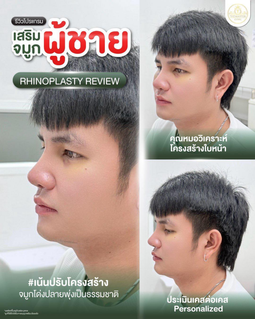 รีวิวคลินิกเสริมความงามกาฬสินธุ์ที่ Themaster Clinic