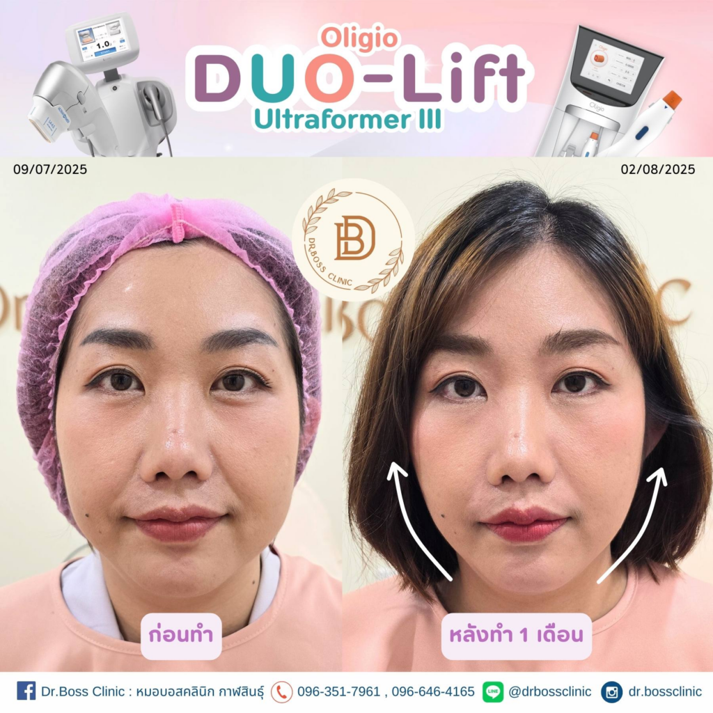 รีวิวคลินิกเสริมความงามกาฬสินธุ์ที่ Dr.Boss Clinic