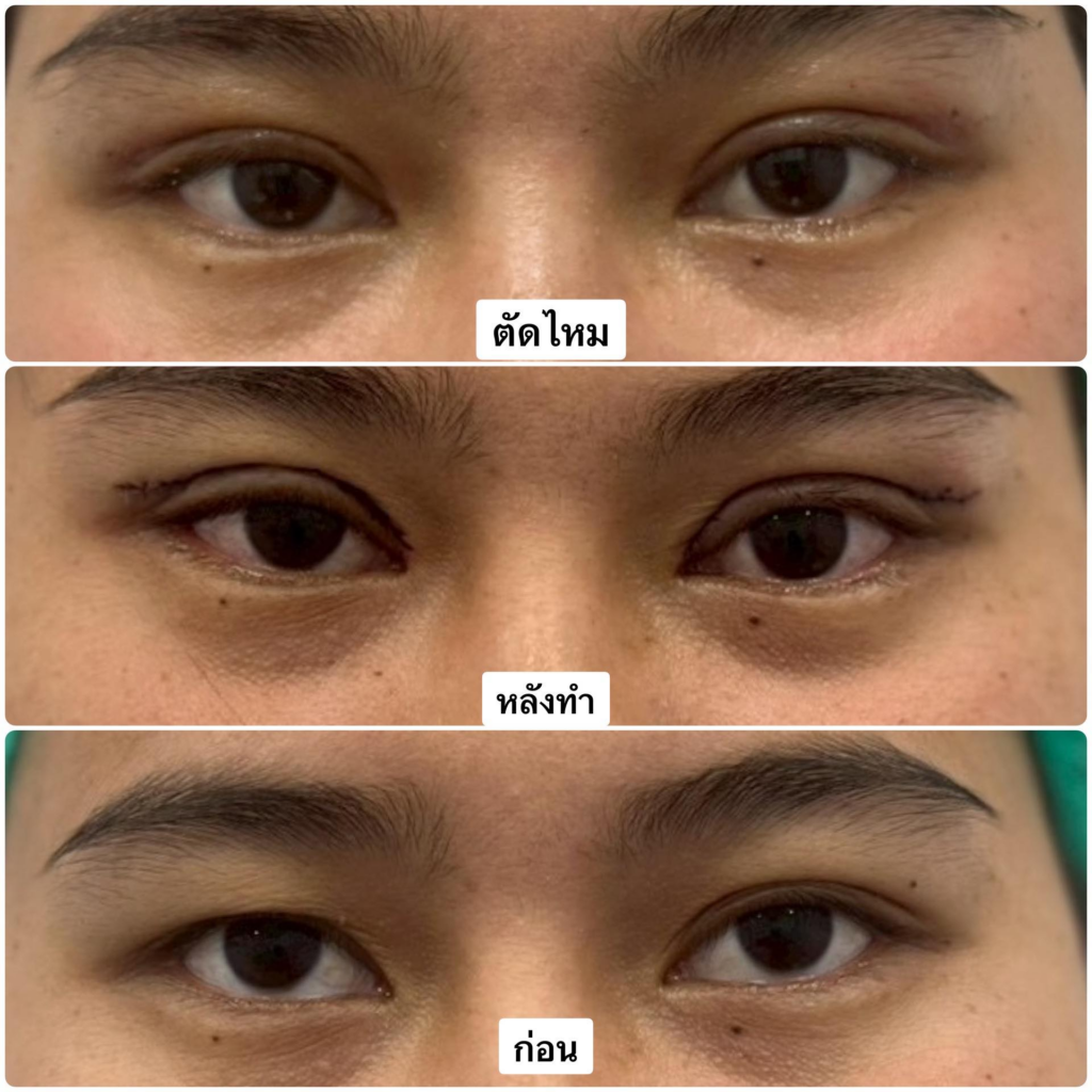 รีวิวคลินิกเสริมความงามกาฬสินธุ์ที่ JSC Clinic