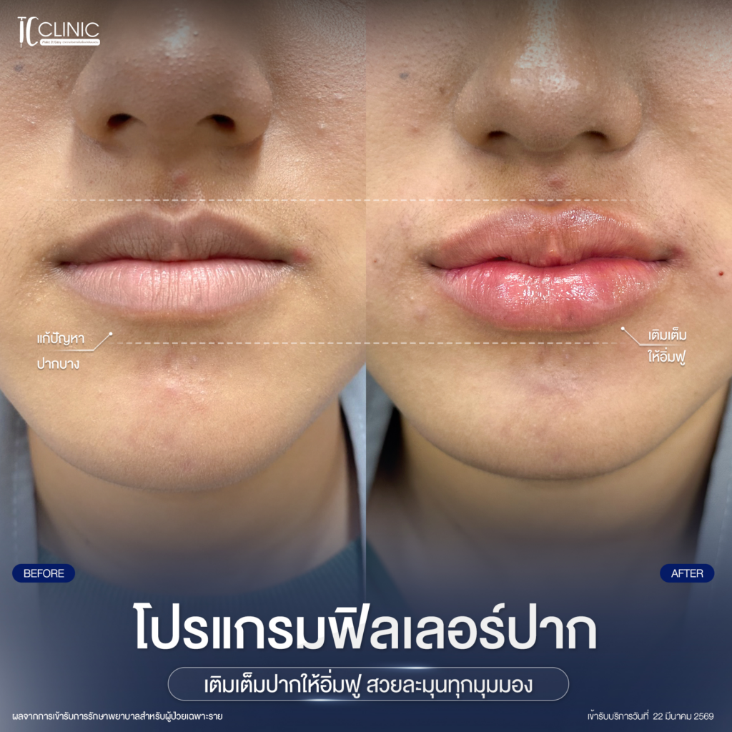รีวิวคลินิกเสริมความงามศรีสะเกษที่ TC Clinic