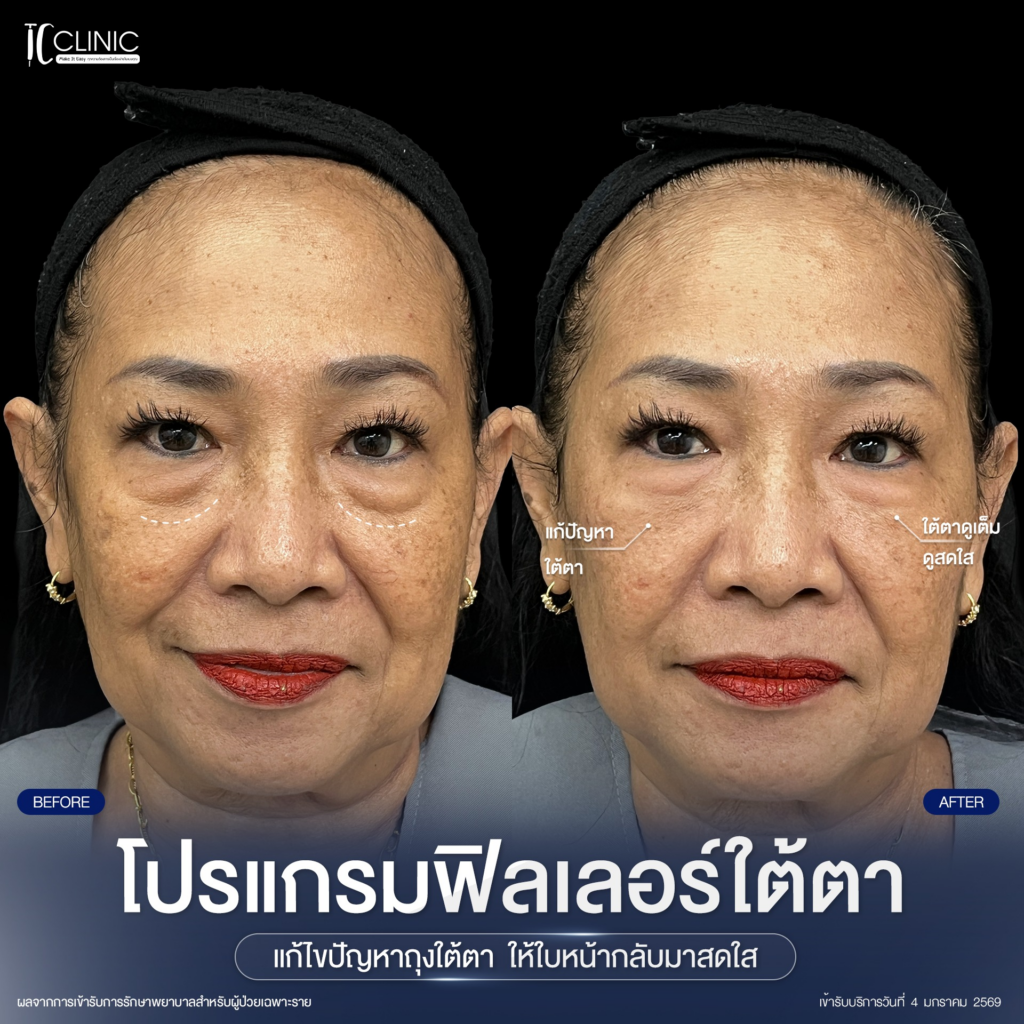 รีวิวคลินิกเสริมความงามศรีสะเกษที่ TC Clinic