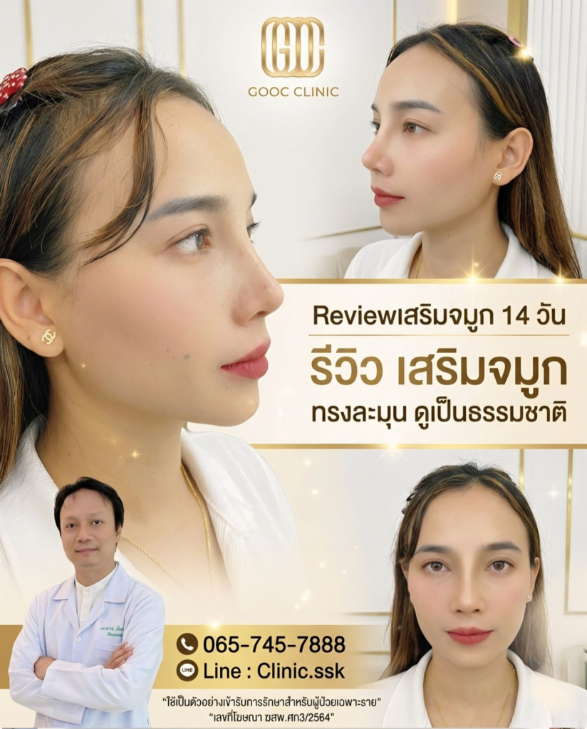 รีวิวคลินิกเสริมความงามศรีสะเกษที่ Gooc Clinic