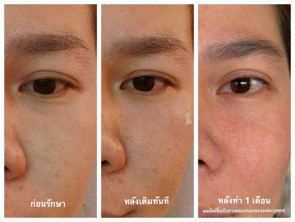 รีวิวคลินิกเสริมความงามศรีสะเกษที่ Madoc Clinic
