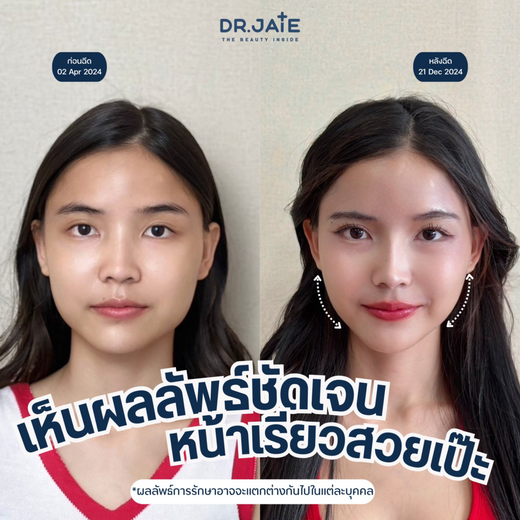 รีวิวคลินิกเสริมความงามศรีสะเกษที่ Dr.Jate Clinic