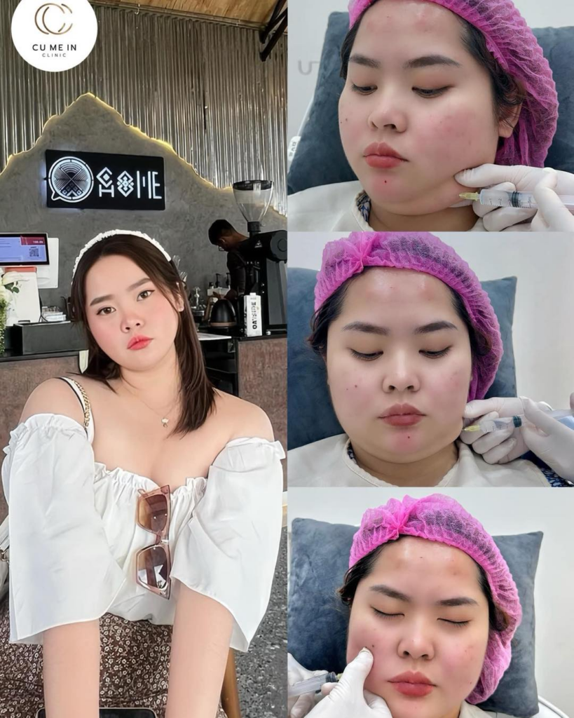 รีวิวคลินิกเสริมความงามศรีสะเกษที่ Cu Me In Clinic