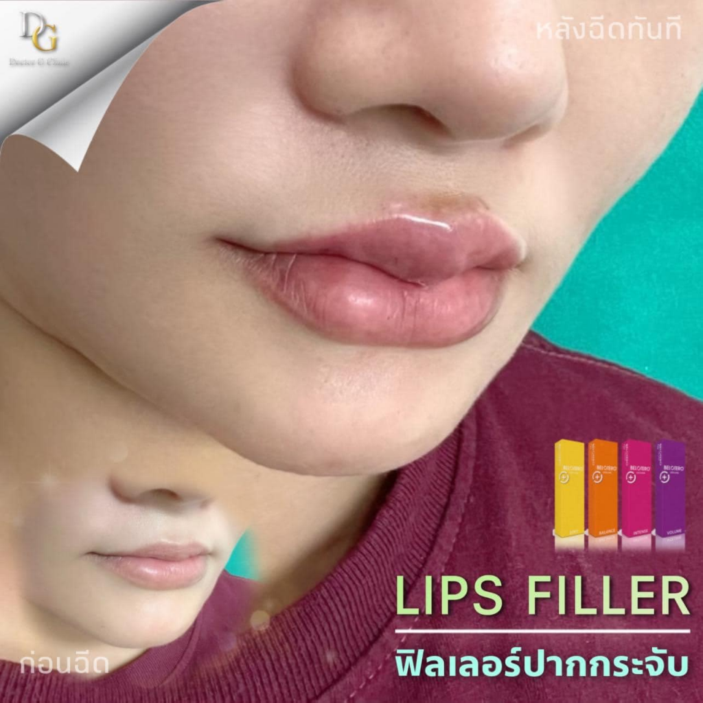 รีวิวคลินิกเสริมความงามศรีสะเกษที่ Doctor G Clinic