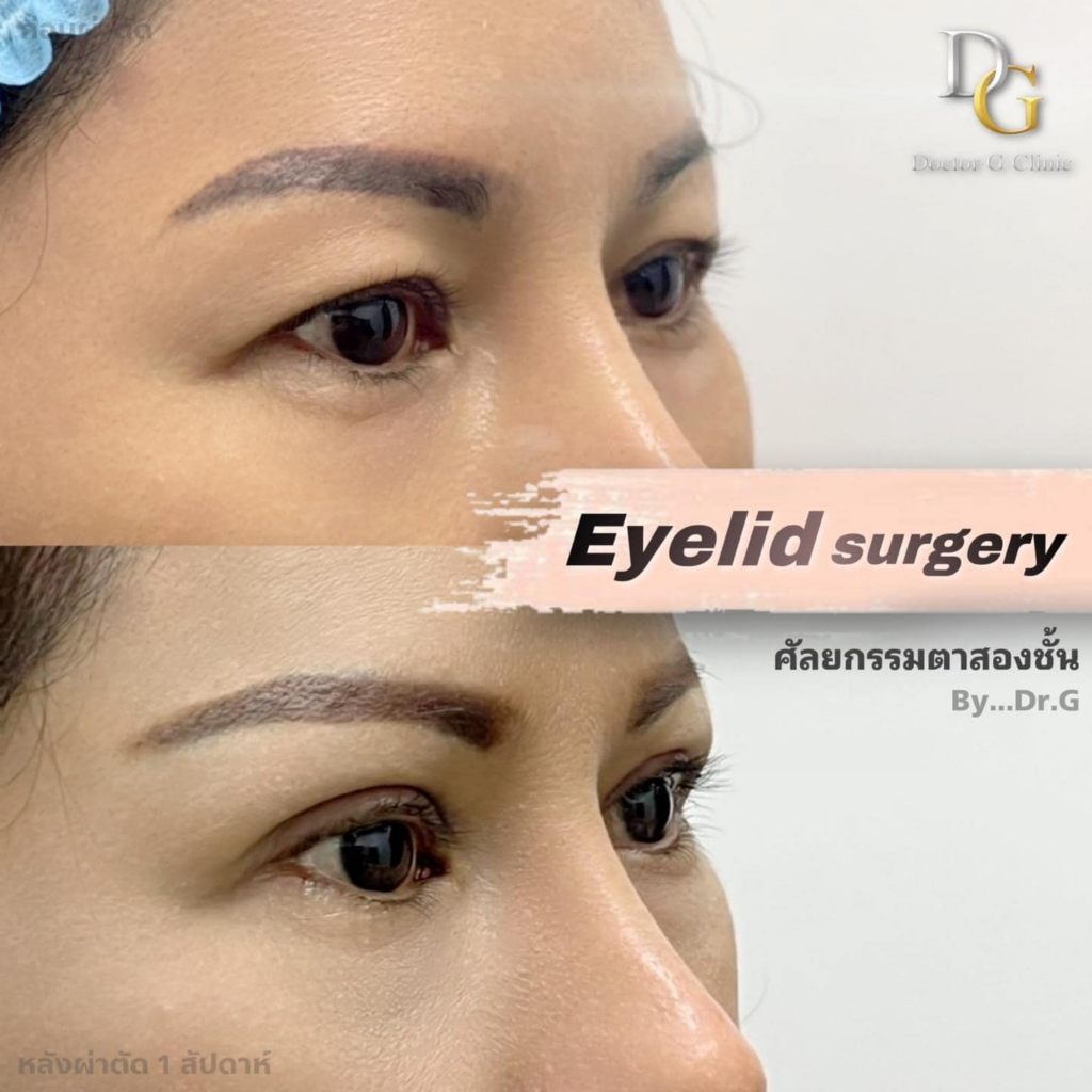 รีวิวคลินิกเสริมความงามศรีสะเกษที่ Doctor G Clinic