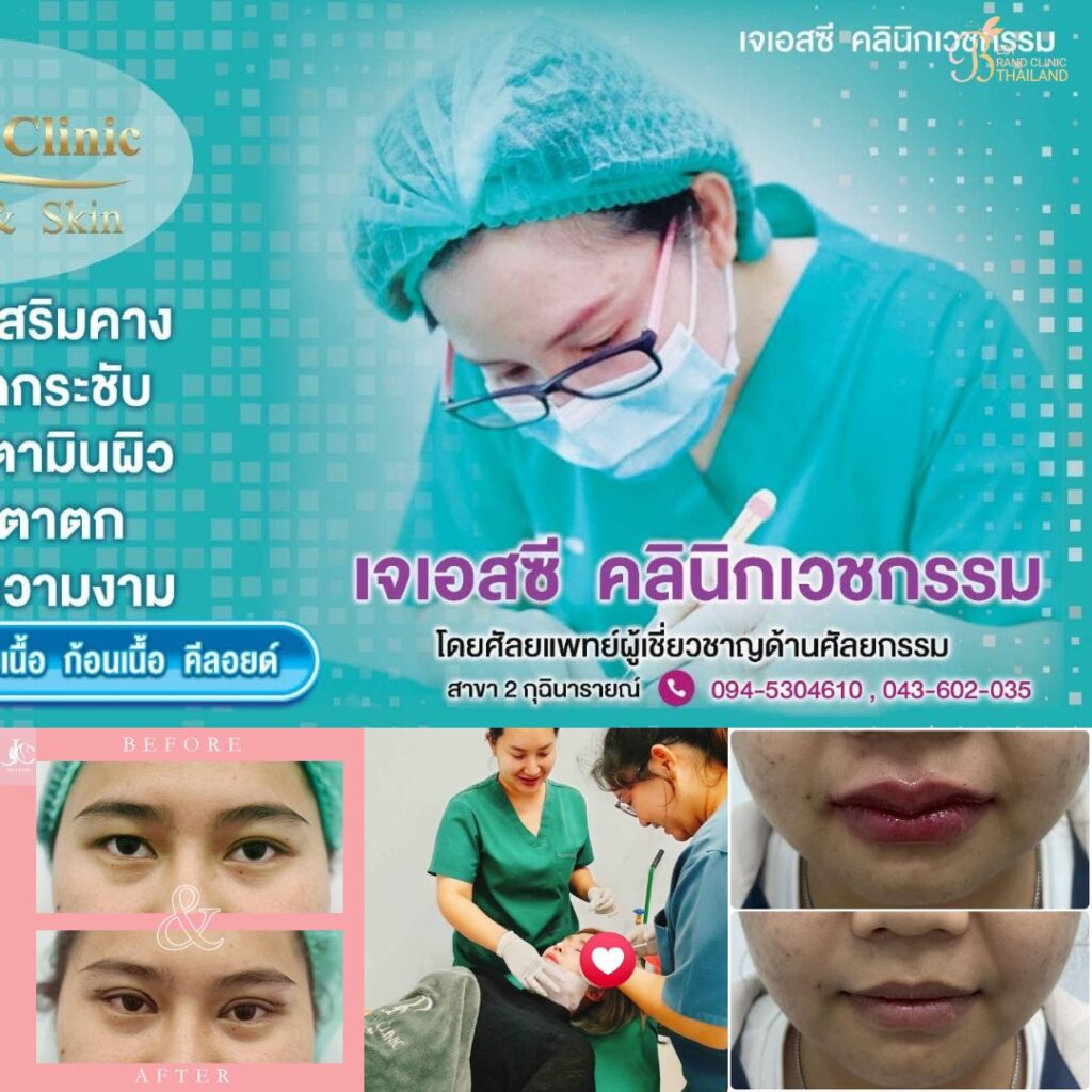 คลินิกเสริมความงามกาฬสินธุ์ที่ JSC Clinic