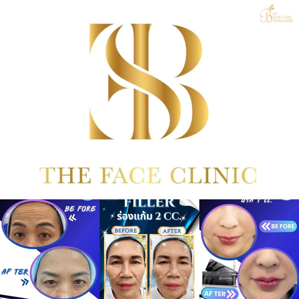 คลินิกเสริมความงามกาฬสินธุ์ที่ The Face Clinic