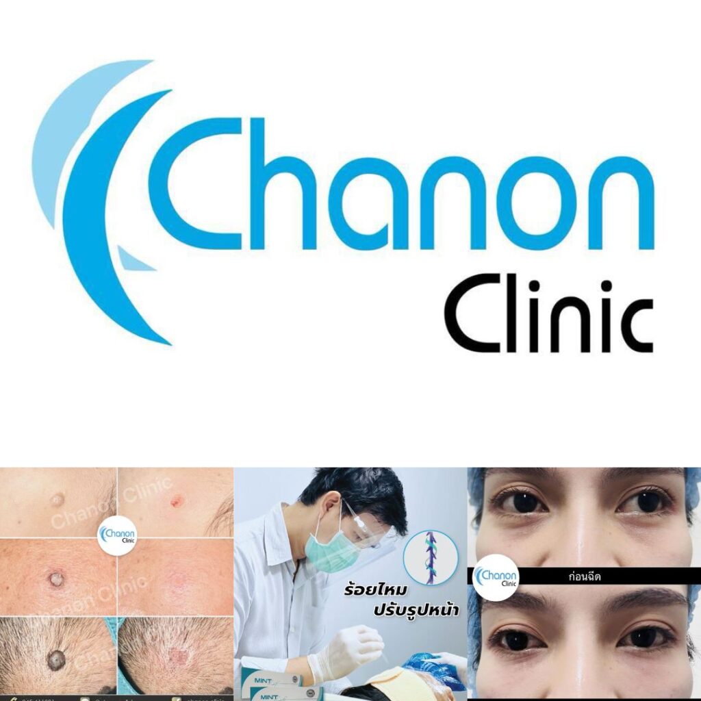 คลินิกเสริมความงามศรีสะเกษที่ Chanon Clinic