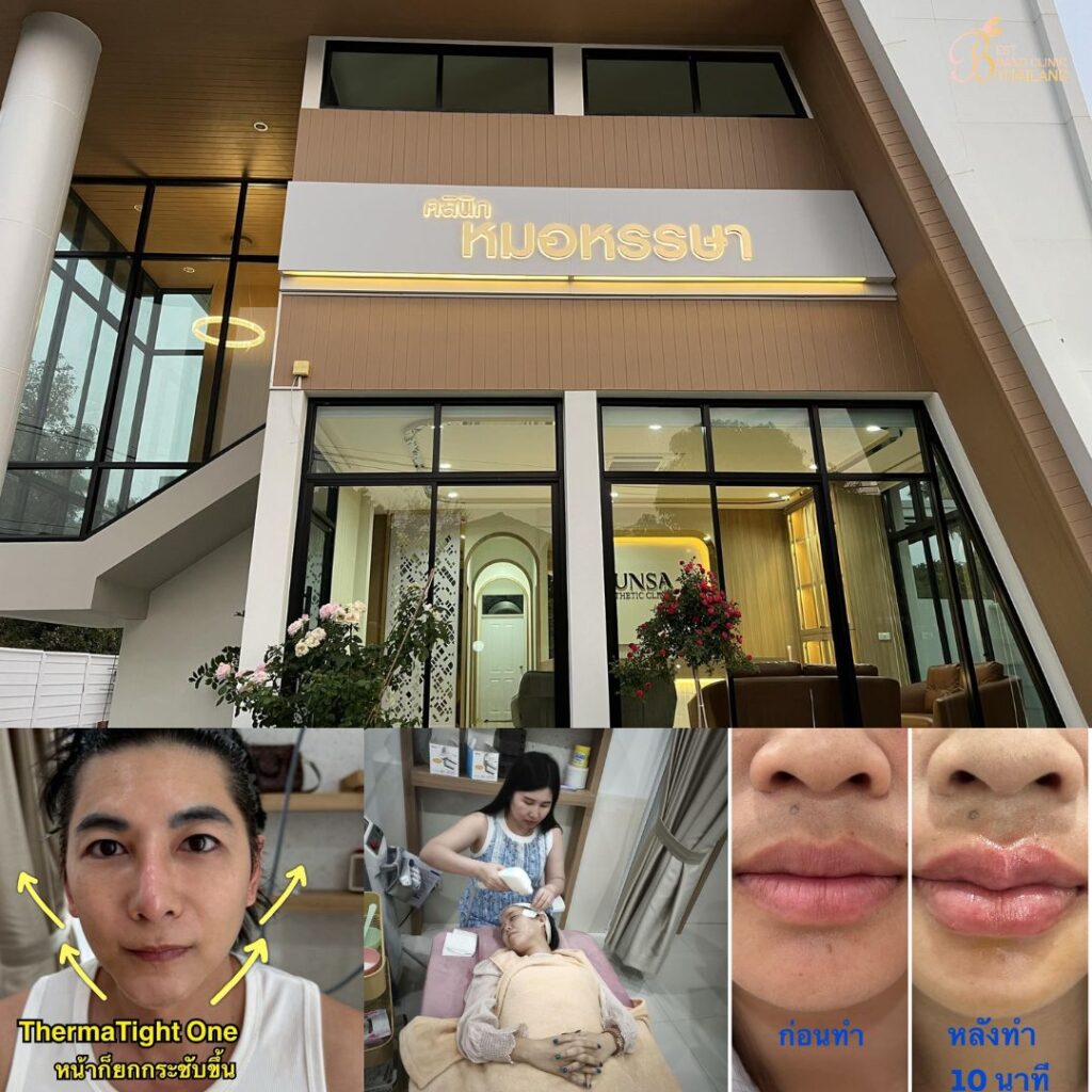 คลินิกเสริมความงามศรีสะเกษที่ Hunsa Aesthetic Clinic